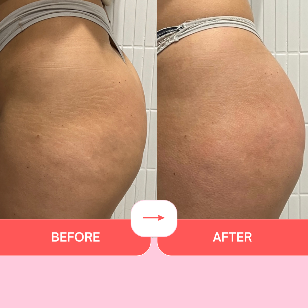 Booty Lift Enhancing & Firming Cream